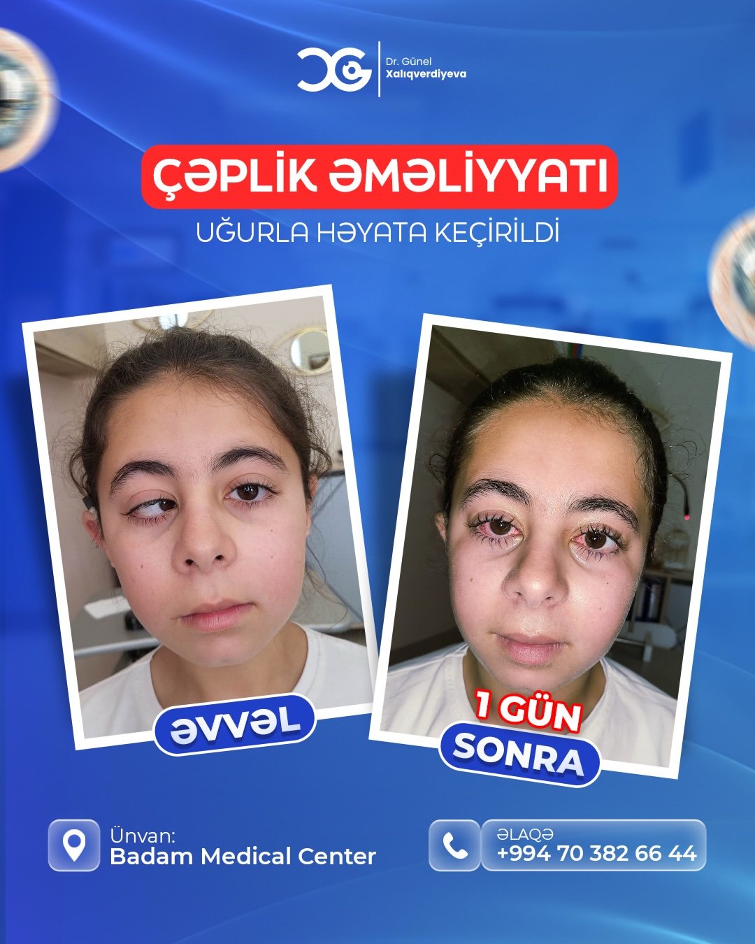 🌟 Kiçik bir dəyişiklik, böyük bir fərq!