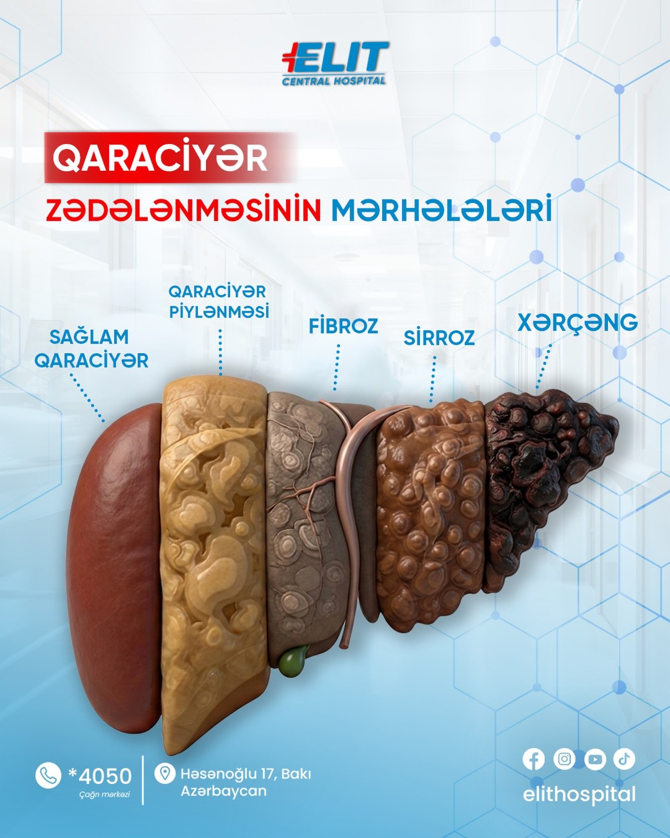 Elit Hospital üçün hazırlanmış kontent
