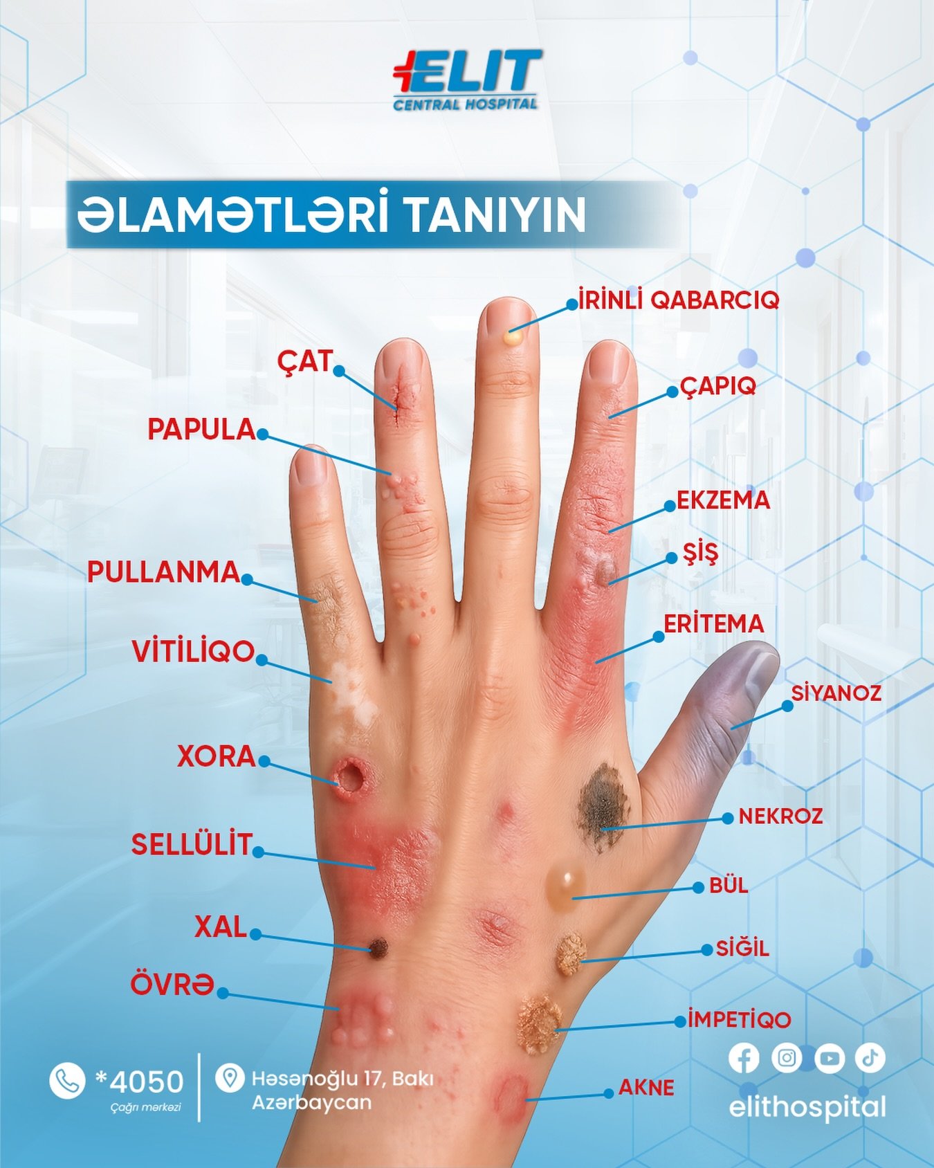 Elit Hospital üçün hazırlanmış kontent